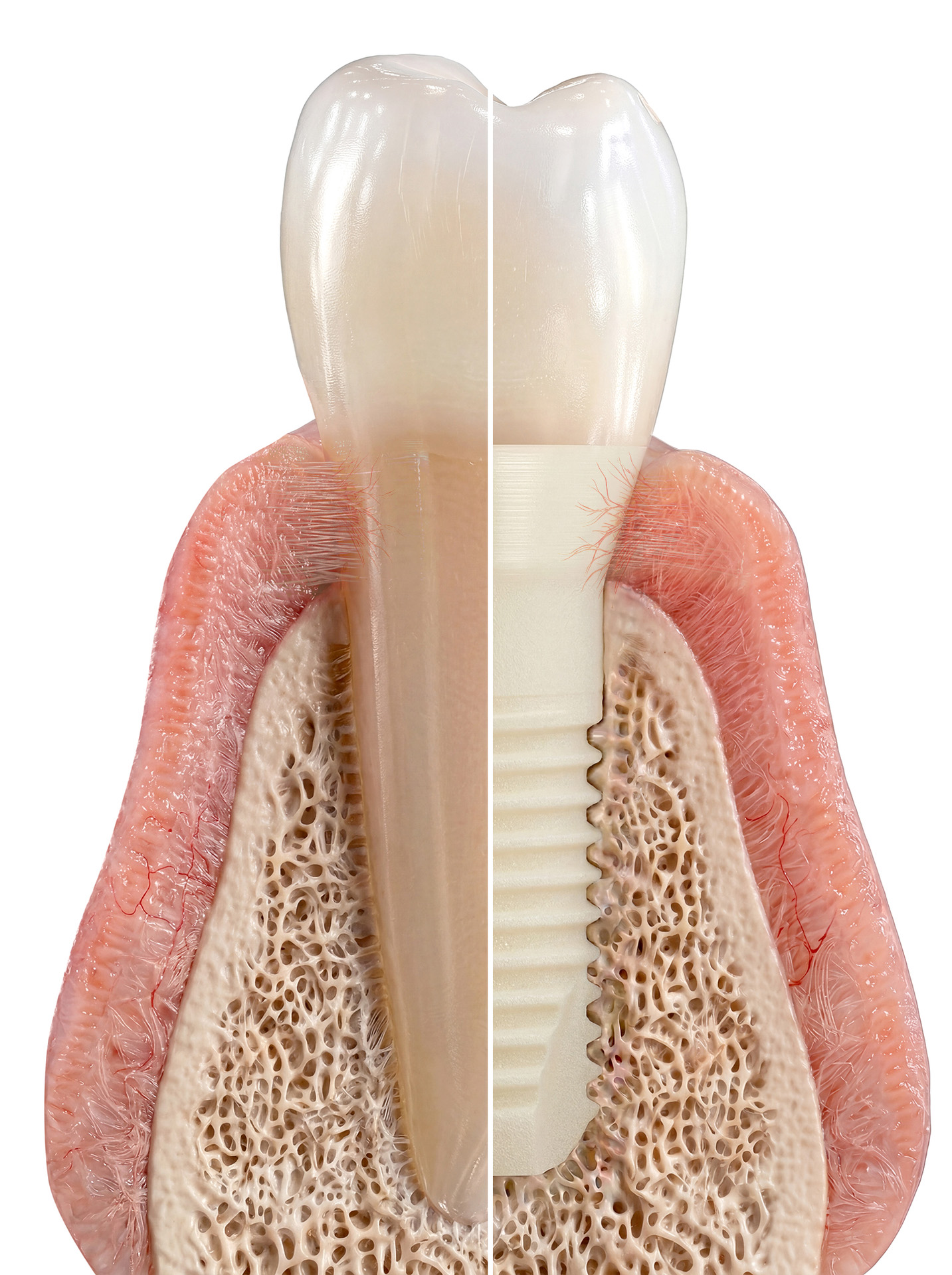 Das Patent Symbionic Teeth System